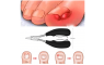 Nagelschaar nagelknipper tegen ingegroeide teennagels Pedicure / HaverCo